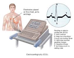 تفسیر ECG به طور کامل بخش دوم-الکتروکاردیوگرافی-مدرسه مهندسی پزشکی-iranianbme.com