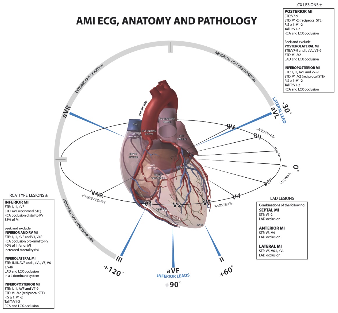تفسیر ECG به طور کامل بخش ششم-ECG-Anatomy-مدرسه مهندسی پزشکی