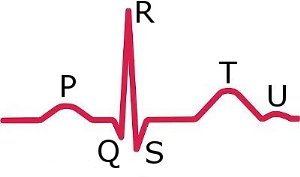 ecg_signal-شبیه ساز ECG قلب بیمار-www.iranianbme.com